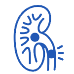 Lithotripsy procedure